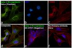 beta-2 Microglobulin Antibody in Immunocytochemistry (ICC/IF)