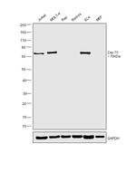 Zap-70 Antibody in Western Blot (WB)