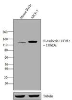 N-cadherin Antibody in Western Blot (WB)