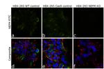 NEFM Antibody in Immunocytochemistry (ICC/IF)