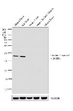 Cardiac Troponin I Antibody