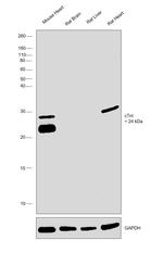 Cardiac Troponin I Antibody in Western Blot (WB)