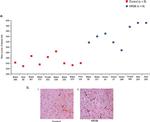 NMDAR2B Antibody in Immunohistochemistry (IHC)