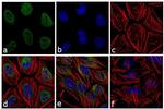 Phospho-ATM (Ser1981) Antibody in Immunocytochemistry (ICC/IF)