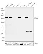 Zap-70 Antibody in Western Blot (WB)