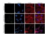 FGF2 Antibody in Immunocytochemistry (ICC/IF)