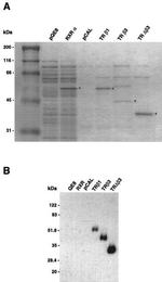 THRA/THRB Antibody in Western Blot (WB)