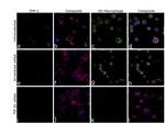 TGF beta-1 Antibody in Immunocytochemistry (ICC/IF)