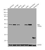 NSE Antibody in Western Blot (WB)