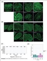 Sarcomeric alpha Actinin Antibody in Immunohistochemistry (IHC)