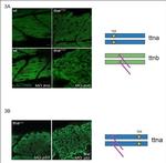 Sarcomeric alpha Actinin Antibody in Immunohistochemistry (IHC)