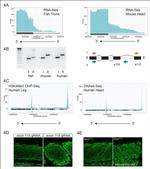 Sarcomeric alpha Actinin Antibody in Immunohistochemistry (IHC)