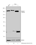 FANCD2 Antibody in Western Blot (WB)