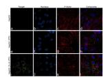 CRP Antibody in Immunocytochemistry (ICC/IF)