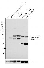 Cardiac Troponin T Antibody