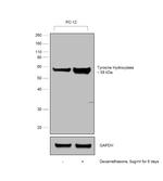 Tyrosine Hydroxylase Antibody