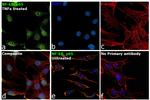 NFkB p65 Antibody in Immunocytochemistry (ICC/IF)