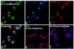 beta Amyloid Antibody in Immunocytochemistry (ICC/IF)