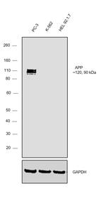 beta Amyloid Antibody in Western Blot (WB)