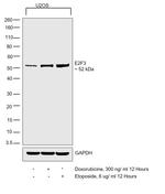 E2F3 Antibody in Western Blot (WB)