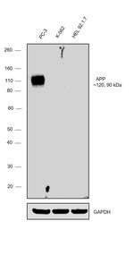 beta Amyloid Antibody