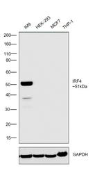 IRF4 Antibody in Western Blot (WB)