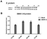 Dengue Virus Type 1-4 Antibody in Western Blot (WB)