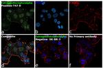 Estrogen Receptor alpha Antibody