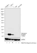 Calprotectin Antibody in Western Blot (WB)