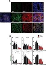 PMCA2 ATPase Antibody in Immunocytochemistry (ICC/IF)