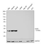 CD20 Antibody