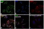 TLR2 Antibody in Immunocytochemistry (ICC/IF)