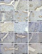 Progesterone Receptor Antibody in Immunohistochemistry (IHC)