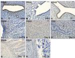 Progesterone Receptor Antibody in Immunohistochemistry (IHC)