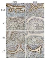 Progesterone Receptor Antibody in Immunohistochemistry (IHC)