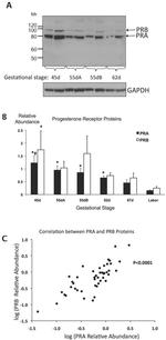 Progesterone Receptor Antibody in Western Blot (WB)