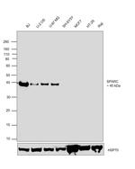 SPARC Antibody