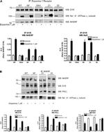 DRD1 Antibody in Western Blot, Immunoprecipitation (WB, IP)