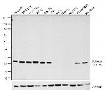 PGP9.5 Antibody in Western Blot (WB)