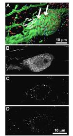 Prolactin Receptor Antibody in Immunocytochemistry (ICC/IF)