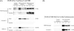 VDR Antibody in Western Blot, Immunoprecipitation (WB, IP)