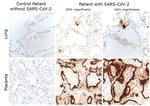 SARS/SARS-CoV-2 Nucleocapsid Antibody