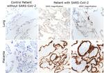 SARS/SARS-CoV-2 Nucleocapsid Antibody
