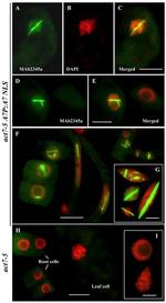 Actin Antibody in Immunocytochemistry (ICC/IF)