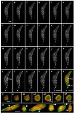 Actin Antibody in Immunocytochemistry (ICC/IF)