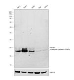 PSEN2 Antibody in Western Blot (WB)