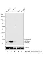 Calprotectin Antibody