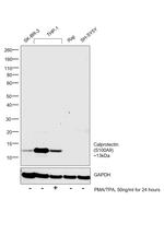 Calprotectin Antibody