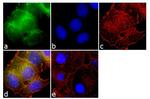 RARB Antibody in Immunocytochemistry (ICC/IF)