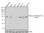 RARB Antibody in Western Blot (WB)